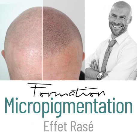 Formation -Trico Scalp