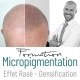 Formation -Trico Scalp