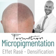 Formation -Trico Scalp