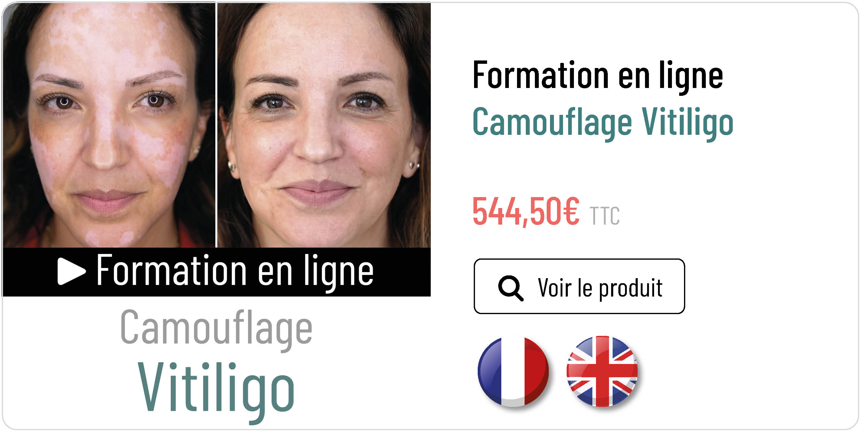 formation-en-ligne-camouflage-vitiligo
